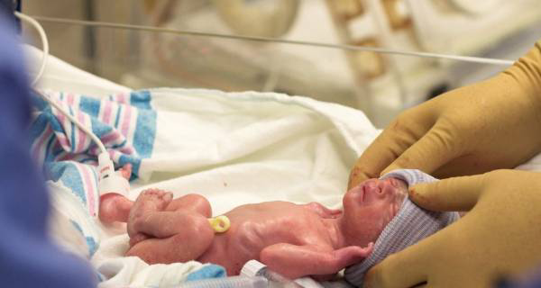 افزایش تولد نوزادان نارس در گیلان