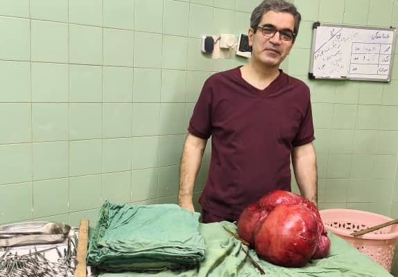 خارج کردن توده ۱۰ کیلویی از شکم بیمار پس از سال‌ها درد