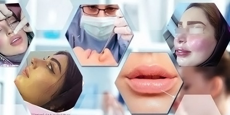 رد پای «ژل‌های سرطانی» بر صورت دختران ایرانی‌ 
