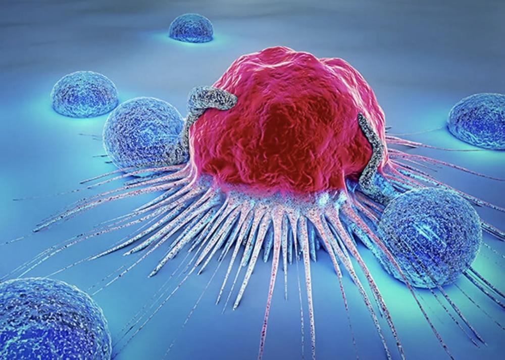 در ایران بین ۳۰ تا ۴۰ دقیقه، یک زن به سرطان سینه مبتلا می شود