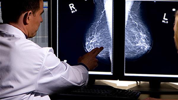 نقش مهم ماموگرافی در تشخیص به موقع سرطان پستان
