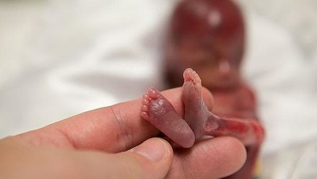 
	 

	آمار«فاجعه‌بار» سقط جنین غیرقانونی!
