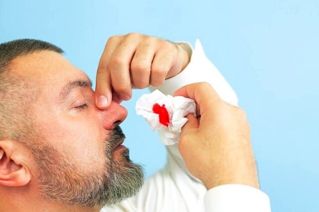چرا خون‌دماغ می‌شویم؟/ شایع‌ترین علل خونریزی بینی 