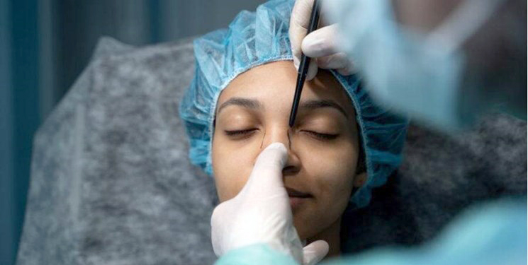 کاهش سن جراحی زیبایی به ۱۴ سال!